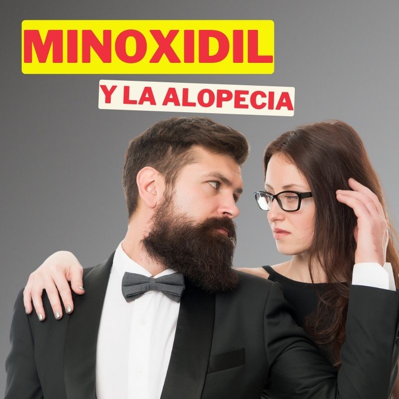 ¿Minoxidil es bueno para la alopecia? Descubre la verdad