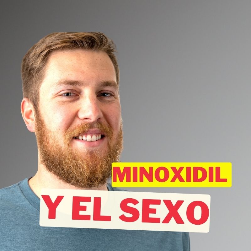 ¿Minoxidil afecta sexualmente? ¡Descubre la verdad ahora!