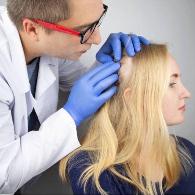 5 Remedios naturales contra la Alopecia