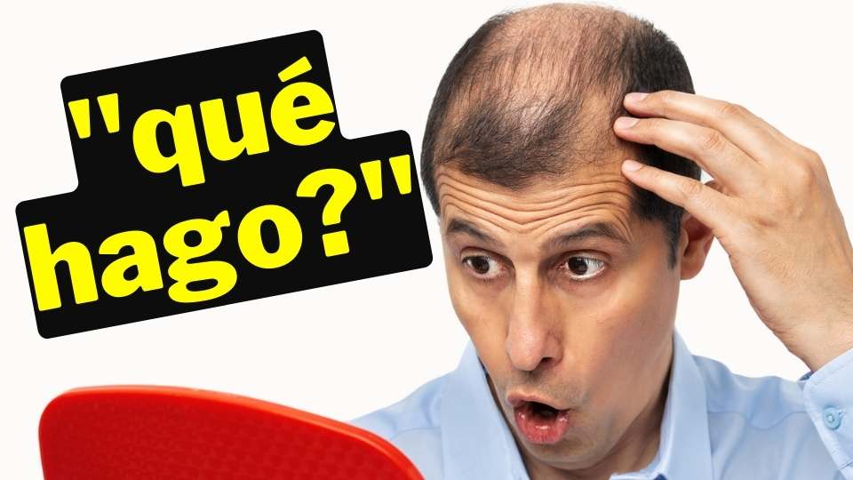 Caída de cabello por estrés - 3 preguntas que comúnmente nos hacemos