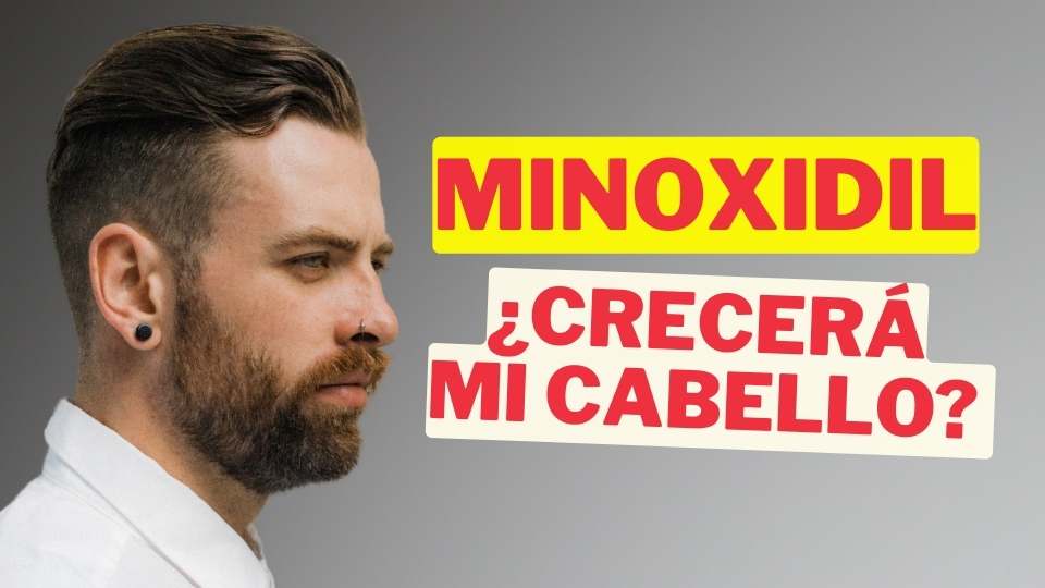 ¿Cómo Funciona Realmente el MINOXIDIL para el Crecimiento del Cabello?