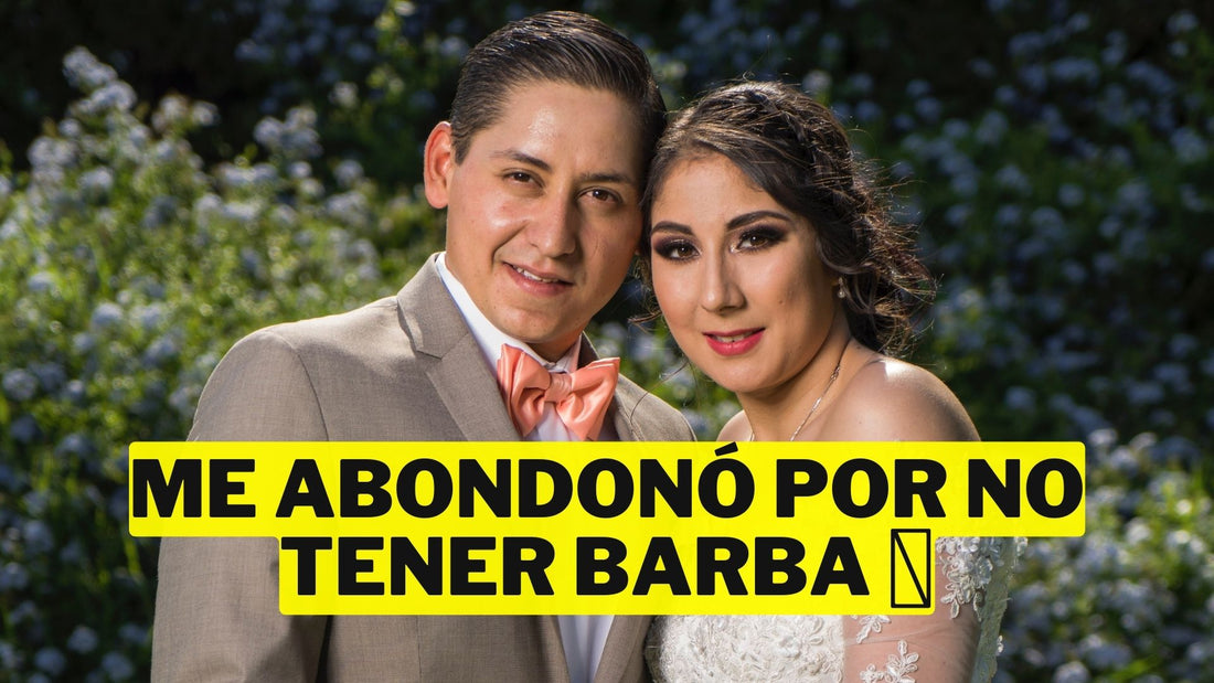 ¡Sorpresa total! Mi ex se casó con alguien de barba: ¿Minoxidil fue su secreto?