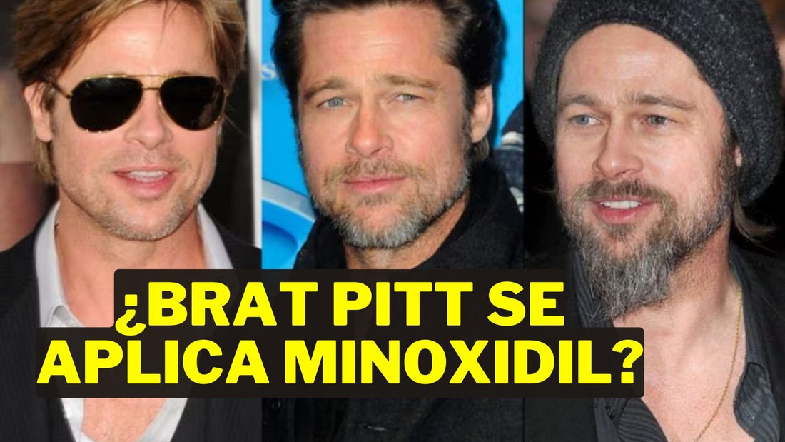 Transforma tu Barba al Estilo Brad Pitt ¡Con Minoxidil!