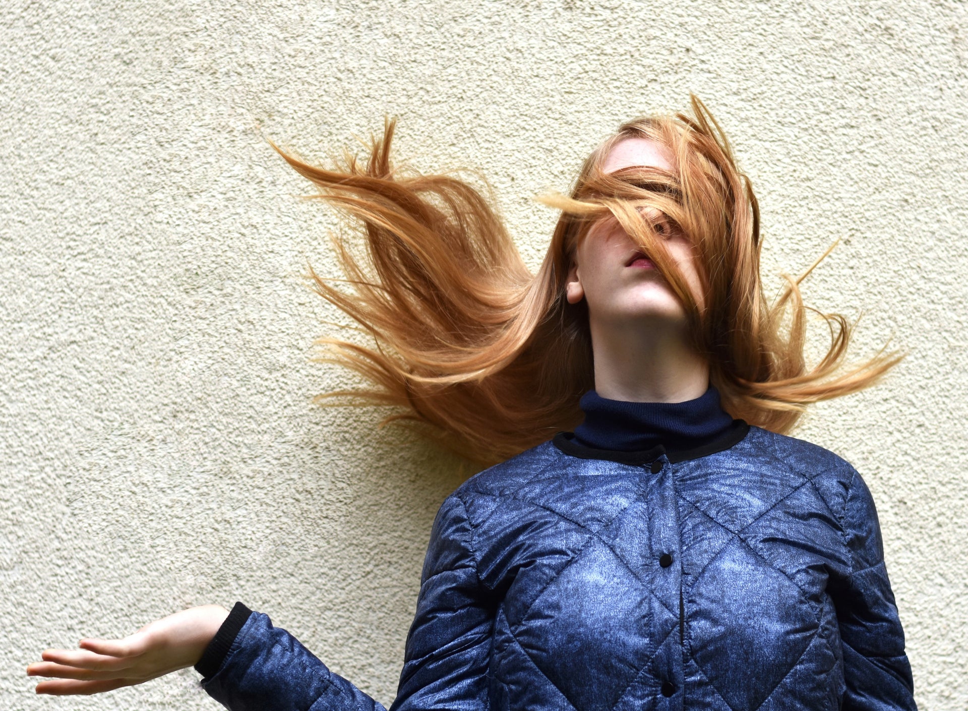 Alopecia Areata: ¿Pueden las Causas Emocionales Ser un Factor?