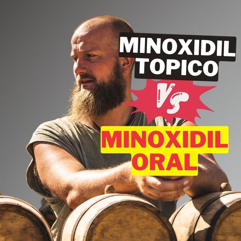Minoxidil oral vs tópico: ¿Cuál es mejor?