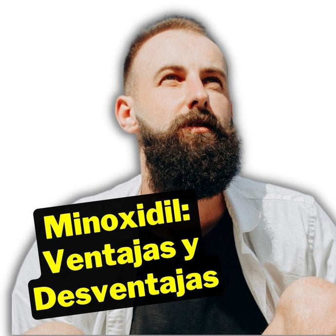 Minoxidil: Ventajas, Desventajas y Alternativas Eficaces