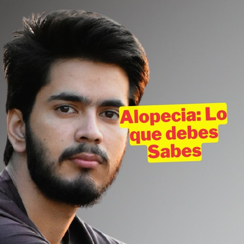 Minoxidil para la Alopecia Androgénica: Lo que Debes Saber