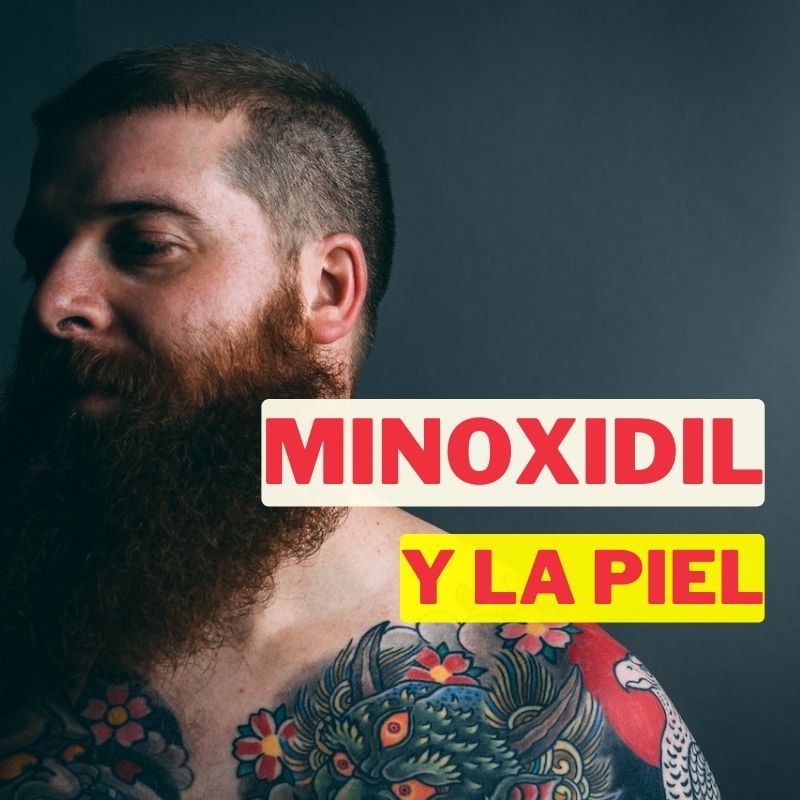 Minoxidil es malo para la piel: ¿mito o realidad? Descúbrelo aquí