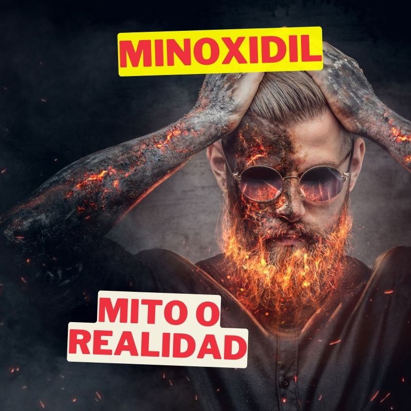 Minoxidil es malo para la piel: ¿mito o realidad? Descúbrelo aquí
