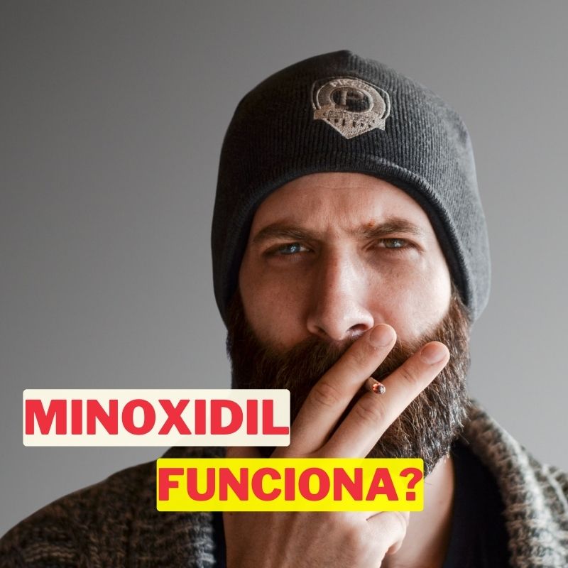 Minoxidil es bueno para la barba: ¡Descubre por qué!