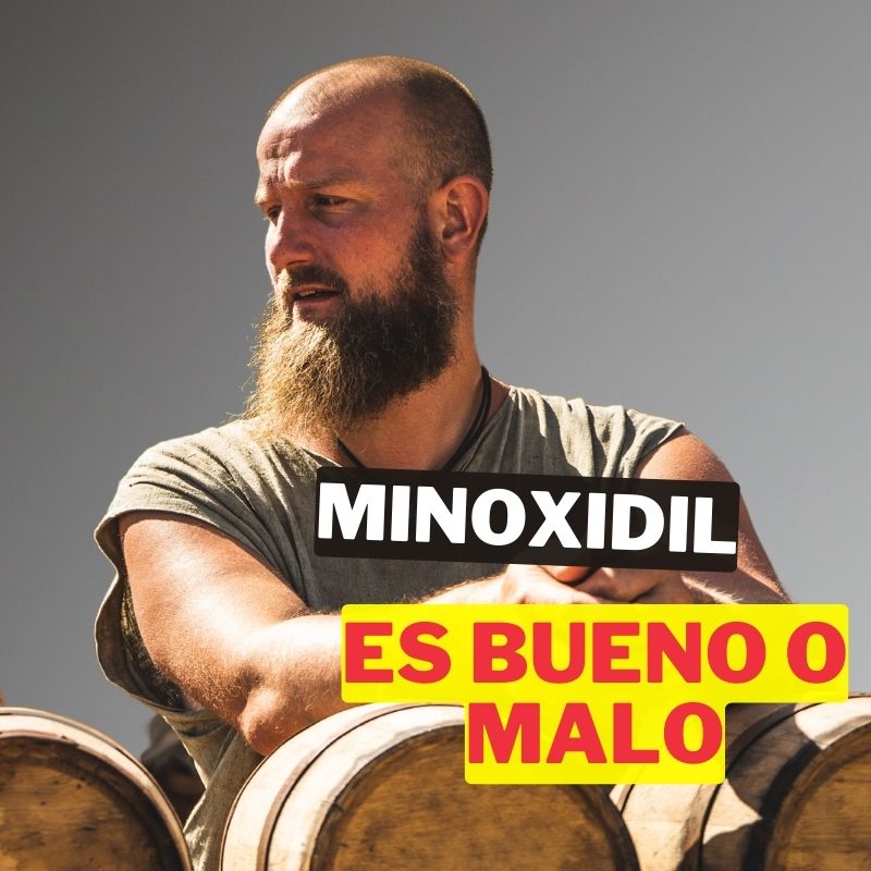 Minoxidil: ¿Es bueno o malo? ¡Descúbrelo aquí!