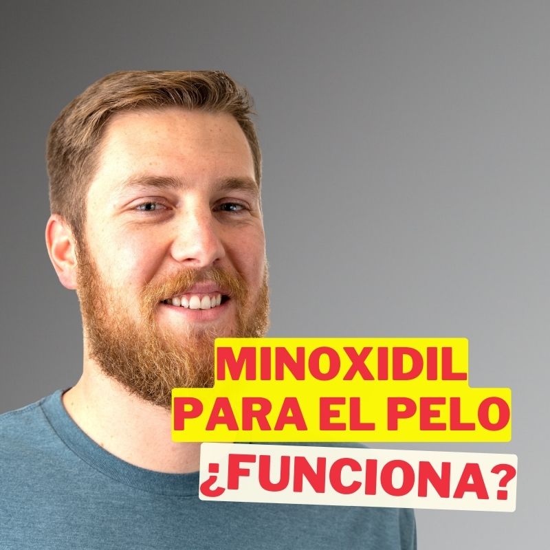 Minoxidil es bueno para el pelo: ¿Realmente funciona?
