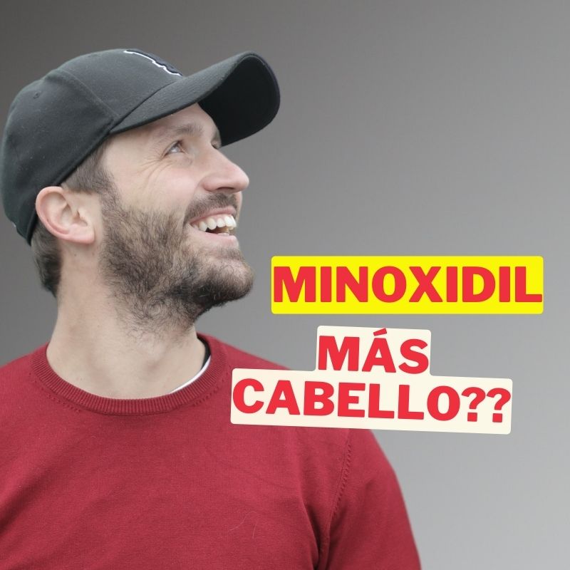 ¿Minoxidil es bueno para la caída del cabello? Descubre la verdad