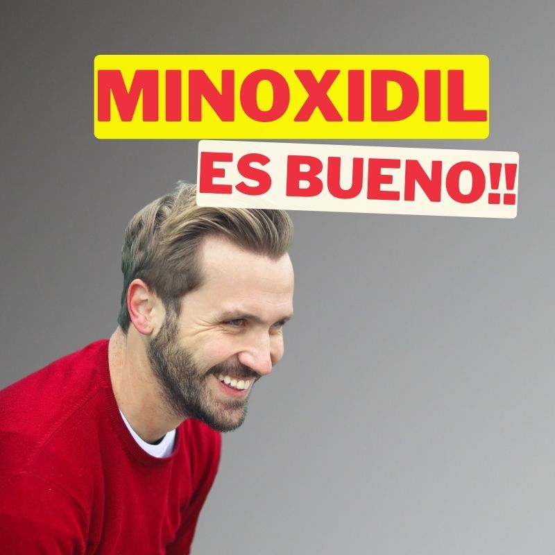 Minoxidil es malo para la salud: ¿Mito o realidad? Descubre la verdad aquí