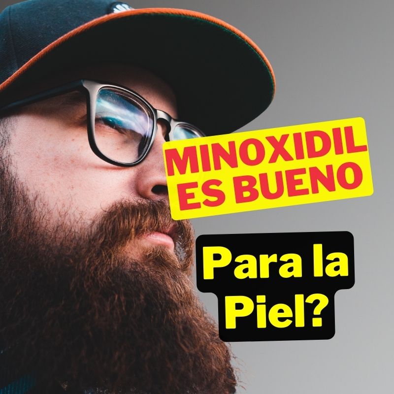 Minoxidil es malo para la piel: ¿mito o realidad? ¡Descúbrelo aquí!