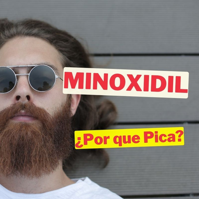 Minoxidil ¿por qué pica? Descubre las razones detrás de esta sensación