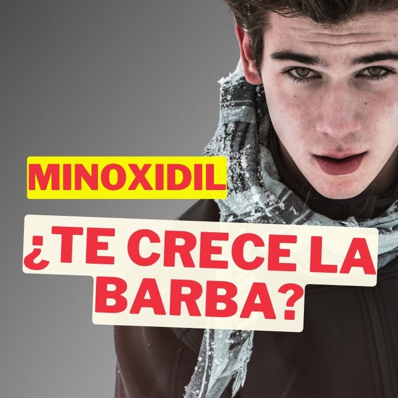 ¿Por qué no me crece la barba con minoxidil? Descubre las posibles causas