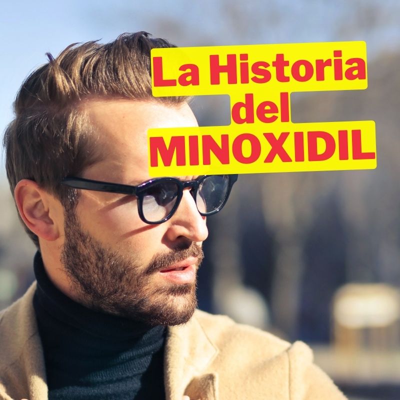 La Historia REAL del Minoxidil desde 1980 [Detalles que nadie te cuenta]