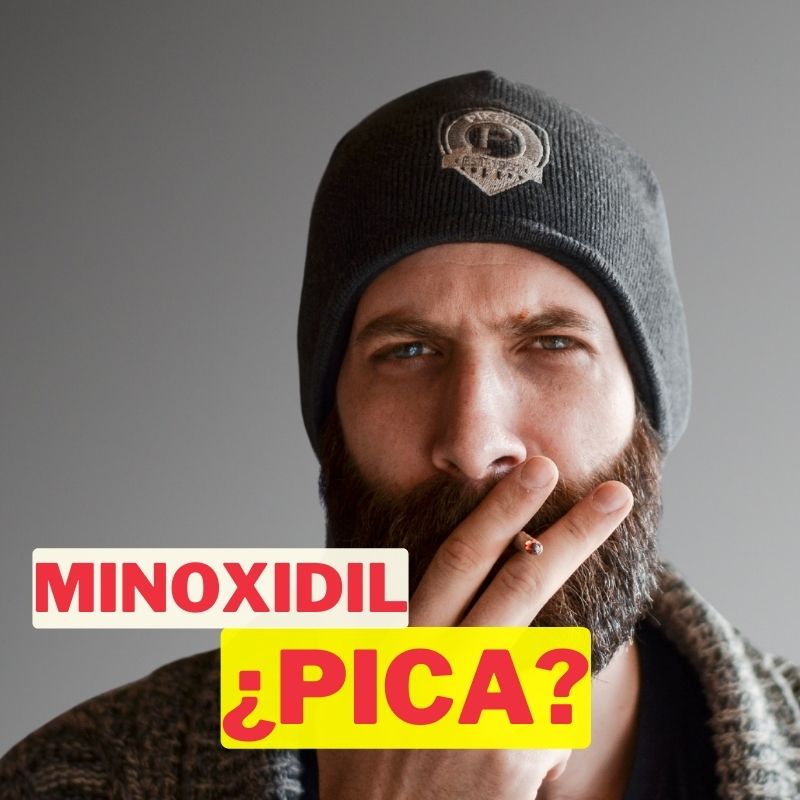 ¿Por qué pica el minoxidil barba? Descubre la respuesta aquí