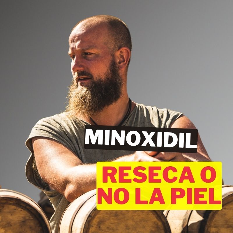 Porqué el minoxidil reseca la piel: ¡Descubre la verdad!