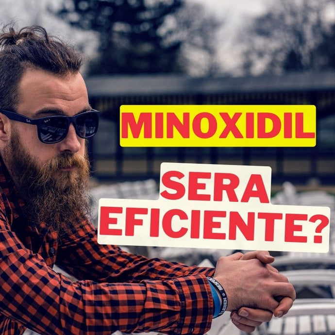 Guía definitiva: Cómo usar minoxidil para el crecimiento de la barba