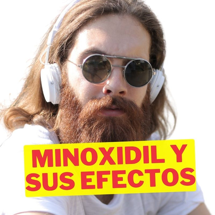 Minoxidil para la Barba: Efectos Secundarios, Beneficios y Alternativas