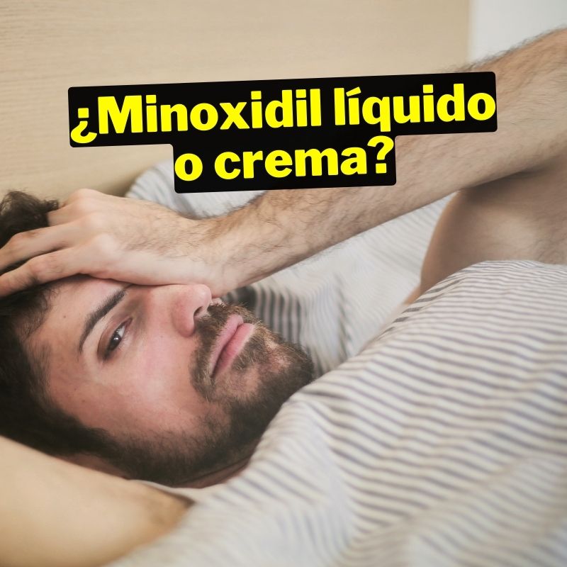 La historia de Omar y su búsqueda del Minoxidil ideal: ¿crema o líquido?