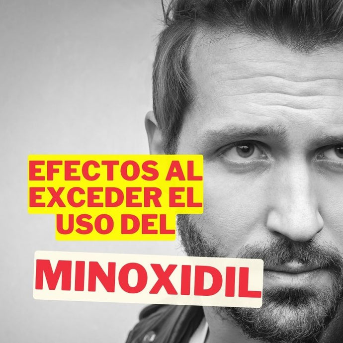 La historia de Charlie Lingan: Efectos secundarios del exceso de minoxidil