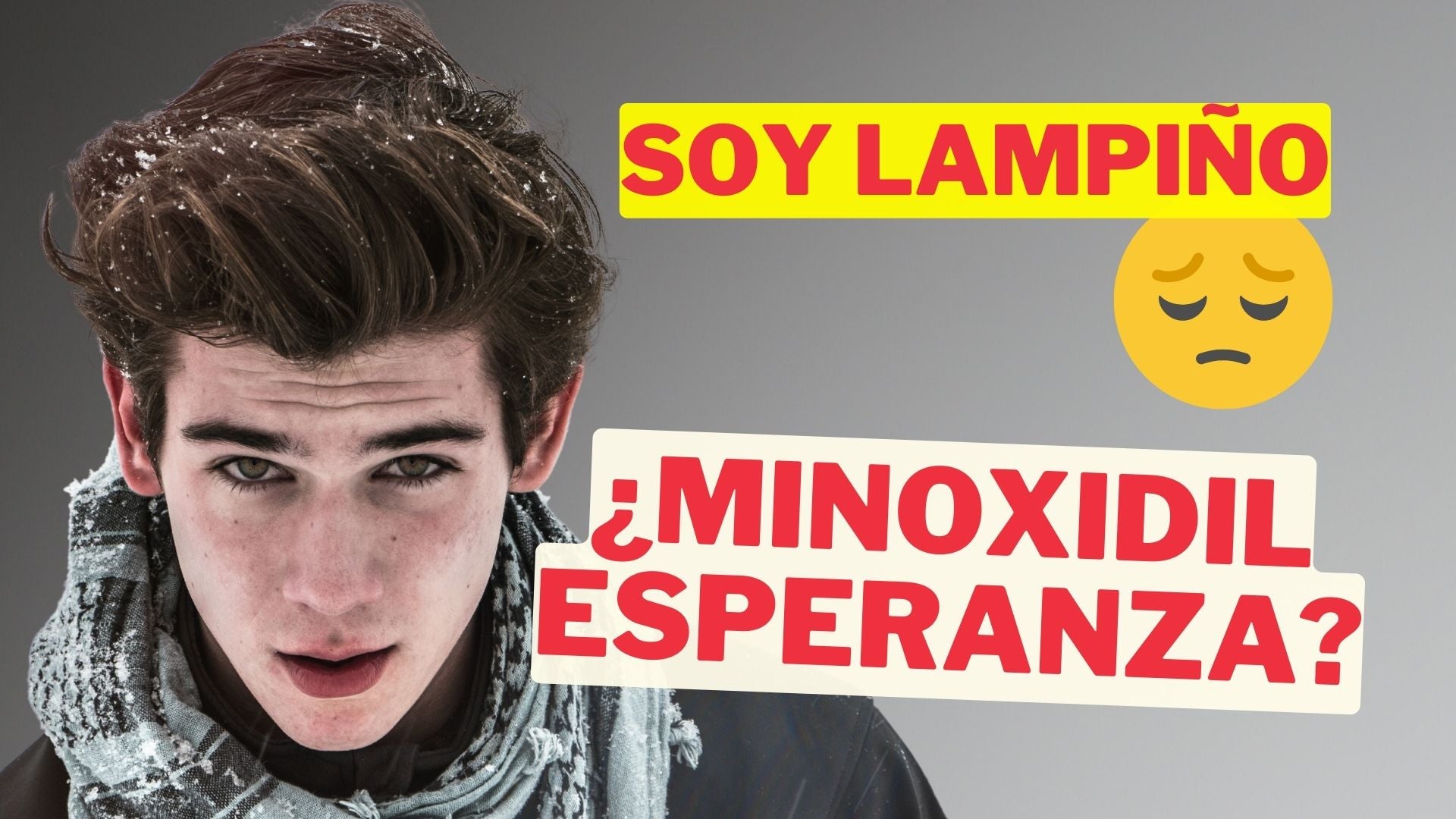 Soy Lampiño: ¿Es posible tener Barba con Minoxidil en Crema? [You Minox]