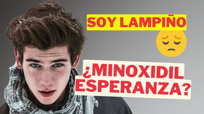 Soy Lampiño: ¿Es posible tener Barba con Minoxidil en Crema? [You Minox]
